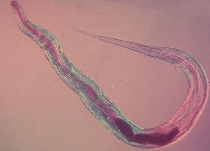 Pinworm под микроскоп