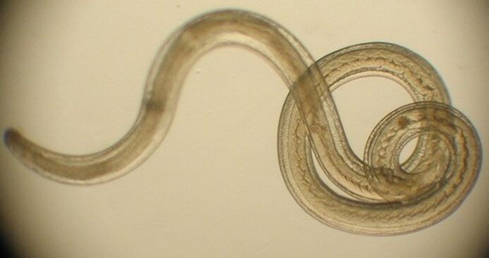 паразит от червеи от човешкото тяло